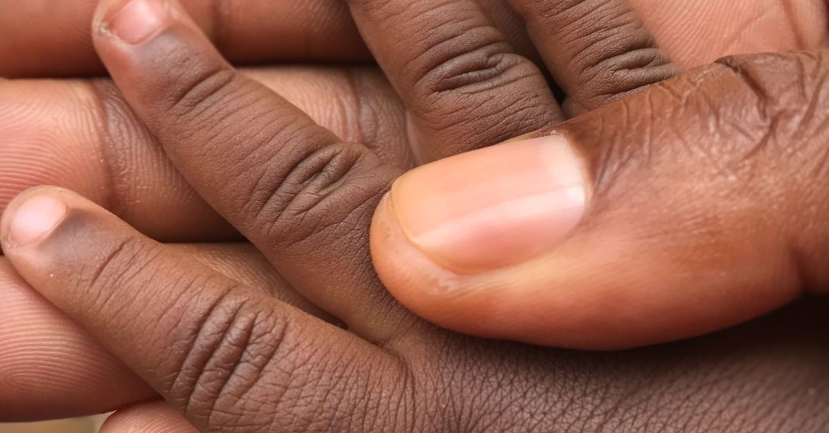 Behandeling 1